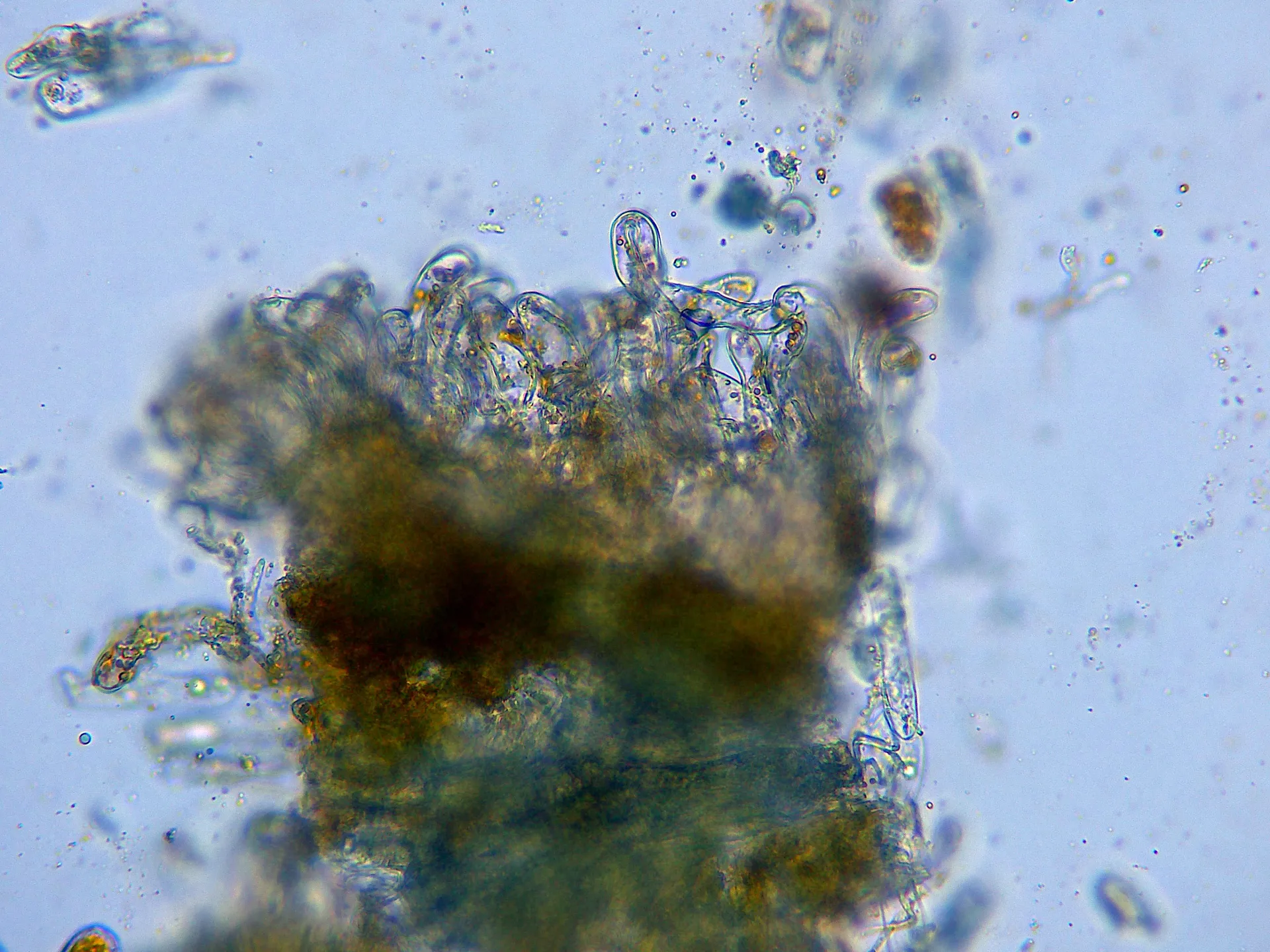 Microscopía de Phragmidium tuberculatum - 16 - x 400-003